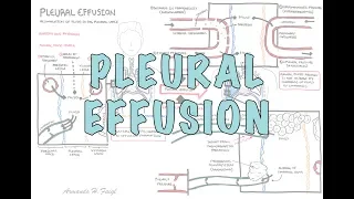 Pleural Effusion (DETAILED) - (pathophysiology, signs and symptoms, treatment)