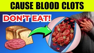 Don't make MISTAKES - STOP EATING these foods that cause BLOOD CLOTS! - Bestie Foods