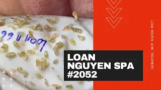 #2052 | LOAN NGUYEN SPA