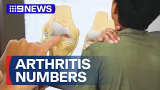 Growing number of millennials to develop arthritis, researchers say | 9 News Australia