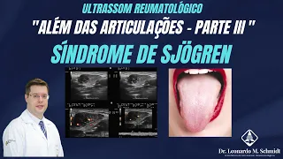 Ultrassom Reumatológico "ALÉM DAS ARTICULAÇÕES" - parte III (SÍNDROME DE SJÖGREN)