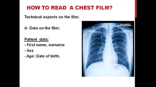 How to read a chest film Dr Hesham El Sheikh