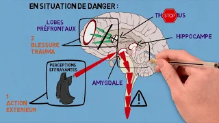 2- Les traumas et leurs conséquences sur le cerveau