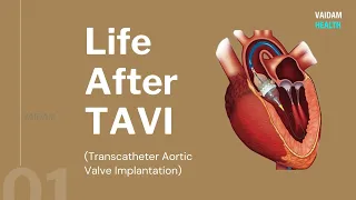Life After TAVI (Transcatheter Aortic Valve Implantation)