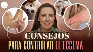 🔴 NO Hagas ESTO empeoras tu ECCEMA @drapilarochoa - Dermatologa