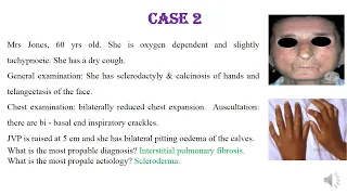 case scenarios IPC 235 respiratory system