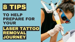 8 Tips To Help Prepare For Laser Tattoo Removal Journey