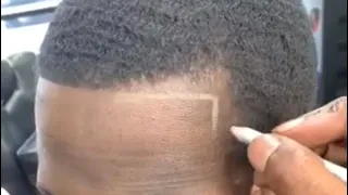 How to fix a receding or pushed back hairline