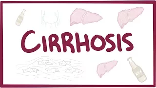 Cirrhosis - causes, symptoms, diagnosis, treatment, pathology