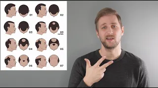 Ab wann macht eine Haartransplantation Sinn und wann auch NICHT!