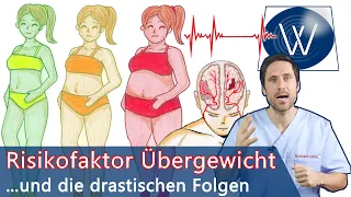 Risikofaktor Übergewicht & Folgen: Warum zuviel Körperfett Lebensjahre kostet & Krankheiten macht