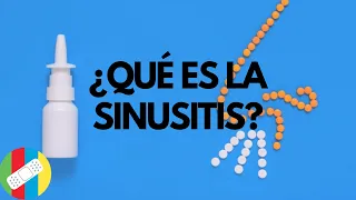 ¿QUÉ ES LA SINUSITIS?