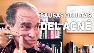 Episodio #1149 Causas Ocultas Del Acné