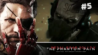 DIAMOND DOGS ► Metal Gear Solid V: The Phantom Pain #5