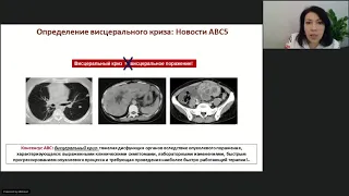 Лекарственное лечение рака молочной железы (вебинар 18 декабря 2020)