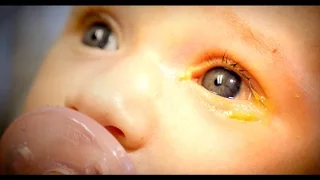 HORRIBLE INFANT EYE INFECTION + Umbilical Hernia | Dr. Paul