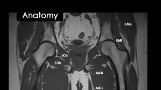 Imaging of the Hip joint  DRE 6   Dr Mamdouh Mahfouz 720p