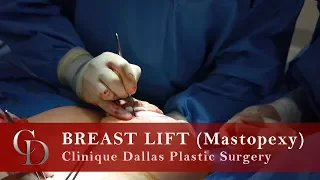 Breast Lift (Mastopexy) - Clinique Dallas Plastic Surgery