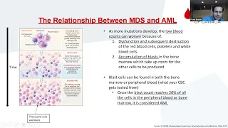 MDS transformation to AML