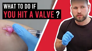 What to do if you hit a valve. - IV cannulation Tips and Tricks