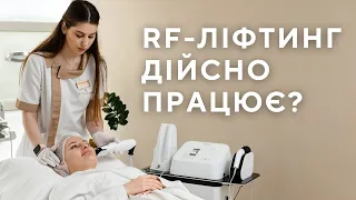 RF ЛІФТИНГ ОБЛИЧЧЯ ДІЙСНО ПРАЦЮЄ⁉️ ЯКИЙ РЕЗУЛЬТАТ?