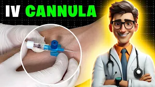 Become an IV Cannulation Pro! IV Cannulation Procedure | IV Cannulation Technique