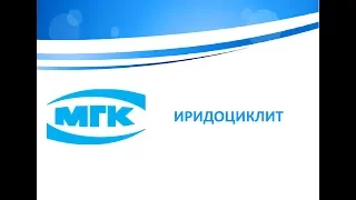 Иридоциклит