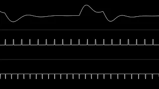 Jammer - “My Own Hyperspace” (C64) [Oscilloscope View]