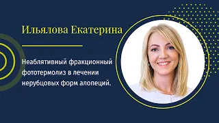 Екатерина Ильялова: Применение фракционных лазеров в трихологии.