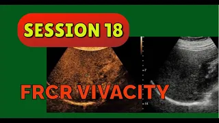 FRCR VIVACITY SESSION 18