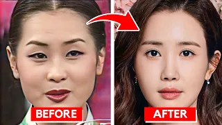 The Dark Truth Behind Lee Da Hae's Face Transformation