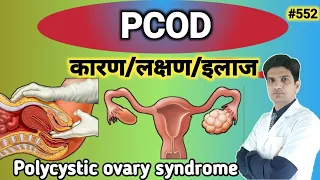 POCD problem solution in hindi  | PCOD treatment in hindi | PCOD kya hota hai