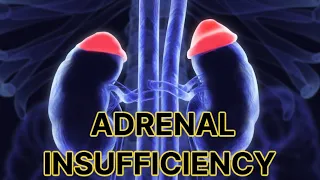 Adrenal Insufficiency (updated 2023) - CRASH! Medical Review Series