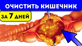 Самая сильная 7-ми дневная чистка кишечника. Как вывести шлаки, каловые камни, застои...