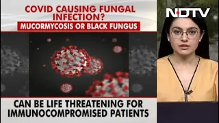 Covid-19 News: Cases Of 'Black Fungus' On The Rise