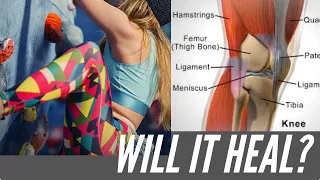 Let's Talk About Your Meniscus Tear...| Will It Heal?