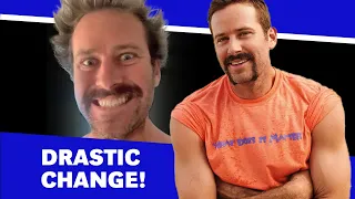 Armie Hammer Is Unrecognizable After Cannibalism Rehab