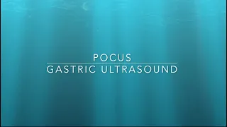 Gastric Ultrasound: An Essential Guide|Gastric ultrasound scan for preoperative assessment