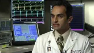 A video about ablation for a irregular heart beat