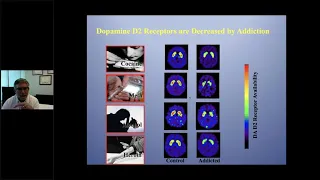 ISSUP Lebanon: Neurobiology of Addiction