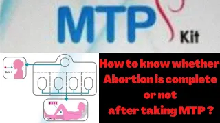 MTP-Kit (Mifepristone and Misoprostol) | How to take MTP kit?  Know whether Abortion is done or not?