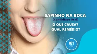 Sapinho Na Boca (Candidíase Oral) – O Que Causa? Qual Remédio?