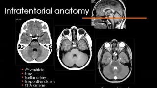 Imaging of Normal brain,pediatric Sep 2013   Dr Mamdouh Mahfouz In Arabic