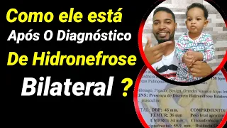 Como nasceu e como vive após o diagnóstico.(Hidronefrose)