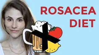 ROSACEA DIET: FOODS, SUPPLEMENTS, PROBIOTICS| DR DRAY