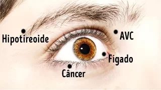 8 COISAS QUE OS SEUS OLHOS PODEM DIZER SOBRE A SUA SAÚDE