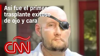 El Dr. Huerta explica cómo se hizo el primer trasplante de ojo y cara
