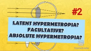 HYPERMETROPIA || What is latent hypermetropia || manifest hypermetropia|| facultative hypermetropia