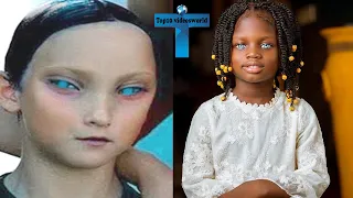 Top 10 Rare And Unique Kids That Are One In A Million!