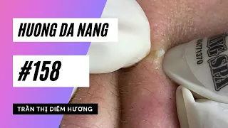 #158 | Huong Da Nang